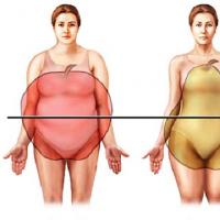 Что такое ожирение Ожирение понятие